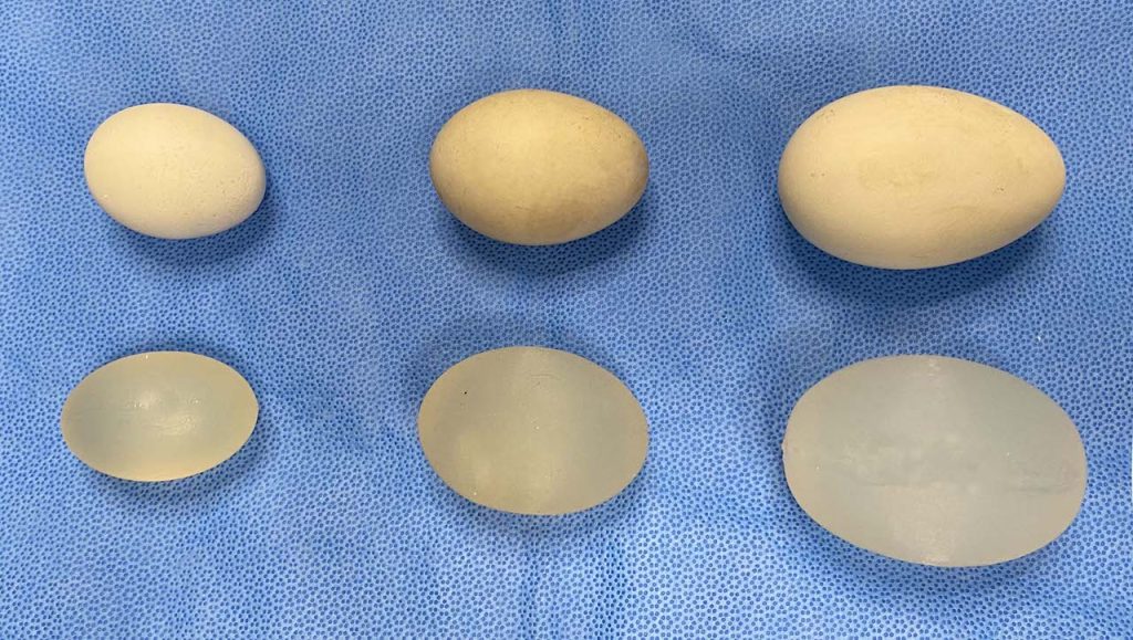 Custom Implant Sizes In Testicular Enhancement The Egg Test Explore Plastic Surgery 