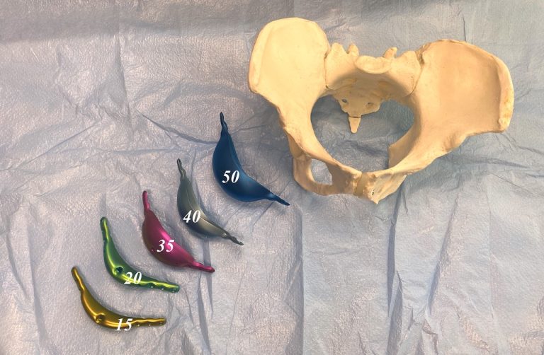 Pelvic Plasty - Iliac Crest Plate Widths - Explore Plastic Surgery