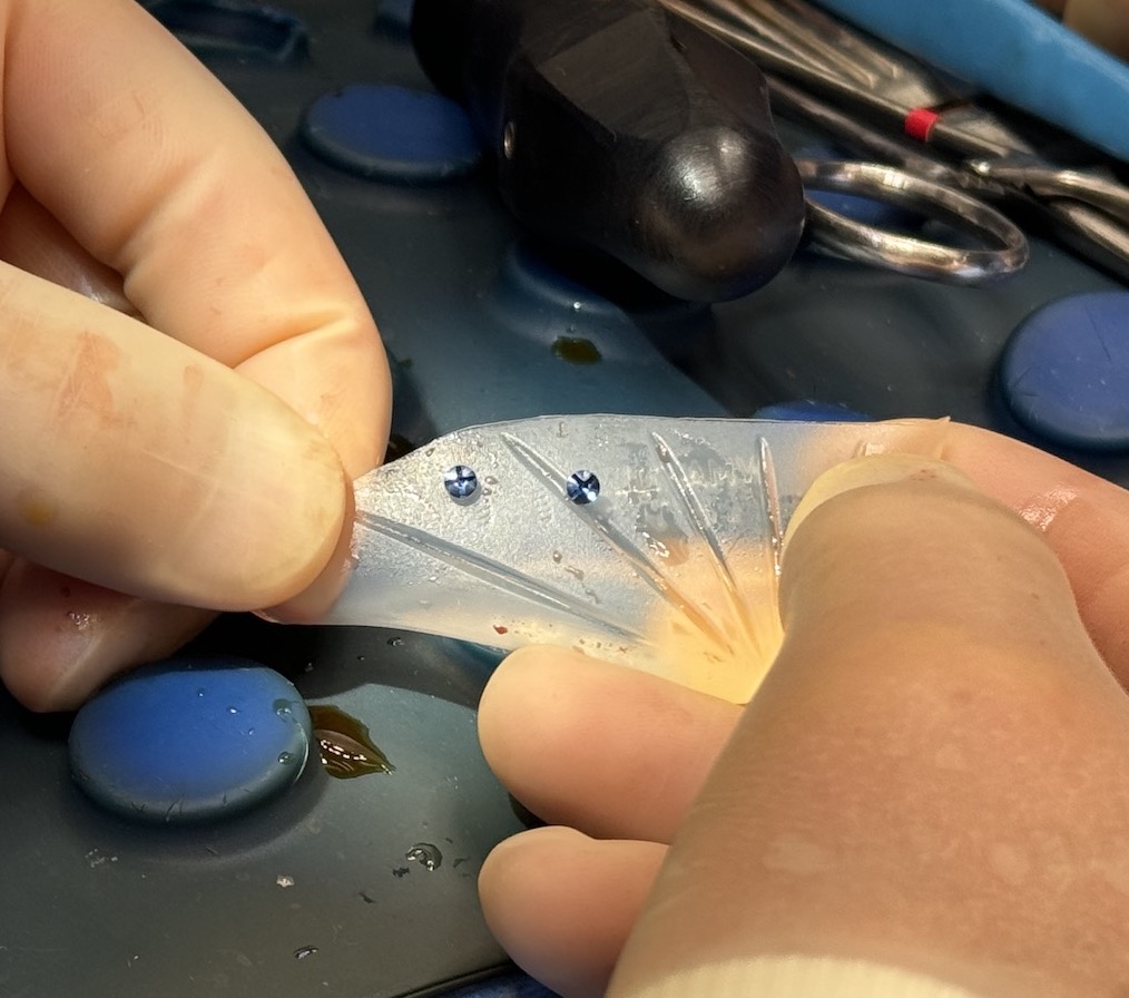 Technical Strategies Pre Placement of Jaw Angle Implant Screws